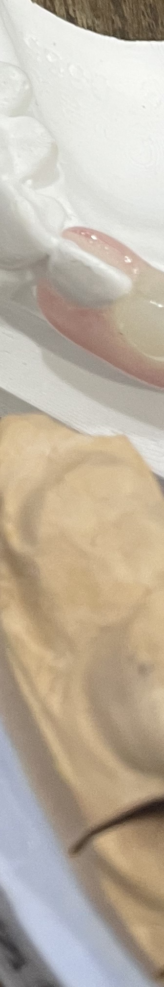 매봉역 치과, 자연치아 잃고 싶지 않다면? 관련 이미지 22