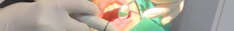 Curettage, for Gum Health image 14