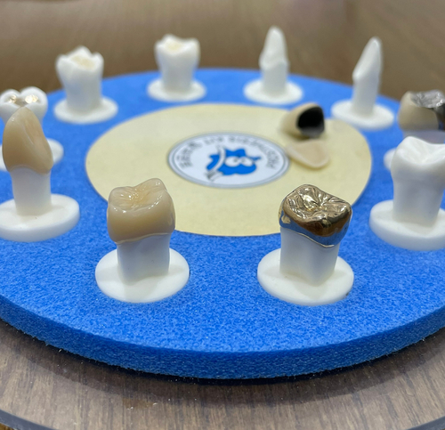 골드? 지르코니아? 이 글만 보시면 크라운 고민 해결됩니다. 관련 이미지 2