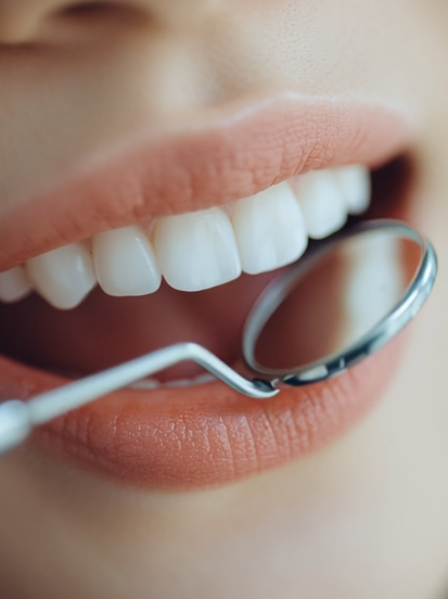 라미네이트 제거, 후기만 보고 가면 안되는 이유 - 의사 작성 관련 이미지 2