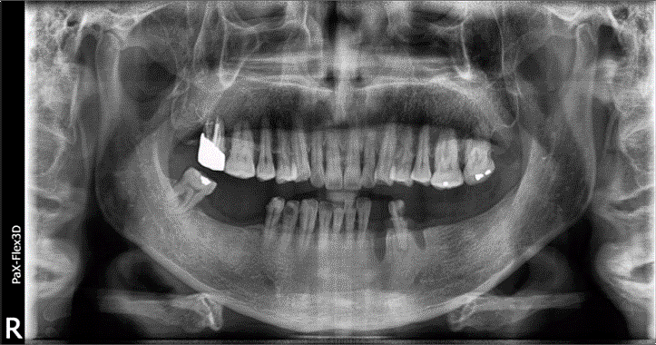 선릉치과? 치료받기 전에 꼭 알아야 할 것 관련 이미지 5