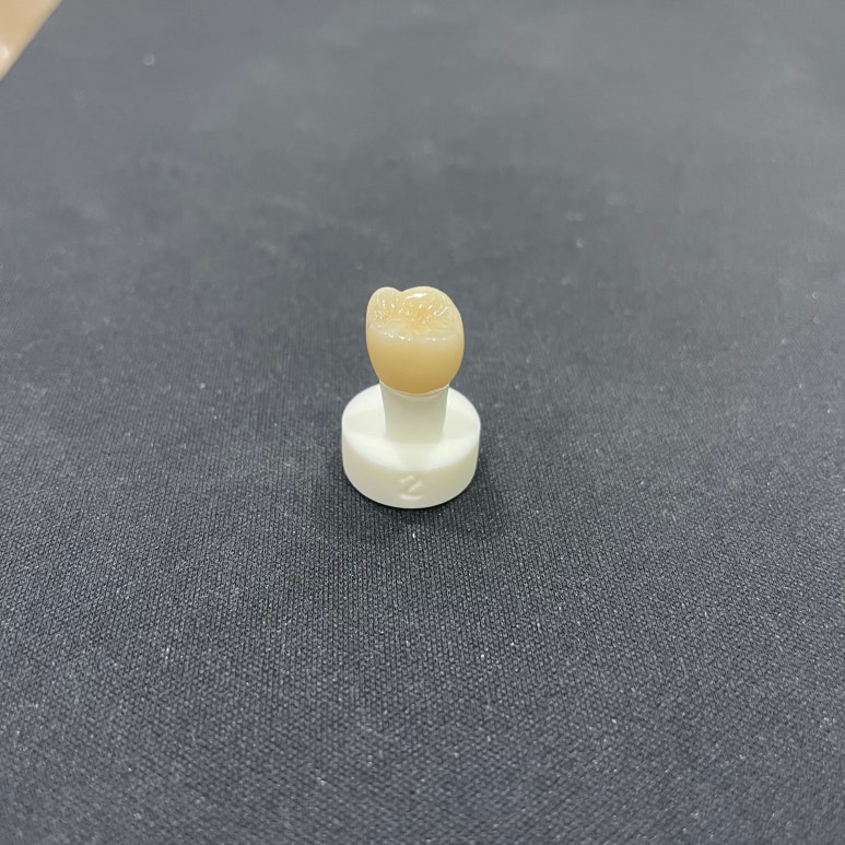 지르코니아크라운 가격만 보고 치과 선택하지 마세요 관련 이미지 4