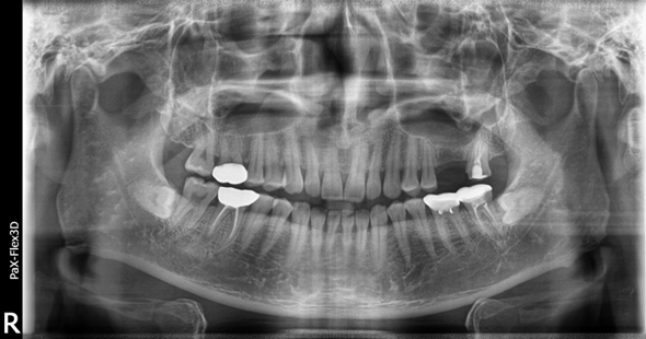 강남치과추천? 내게 꼭 맞는 치과 고르는 방법 관련 이미지 7