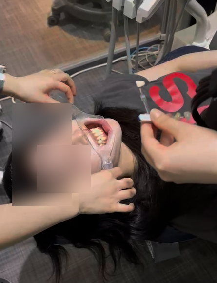 Recommended Dentist Near Gangnam Station: Know This in Advance If You Don't Want to Waste Money on Teeth Whitening image 3