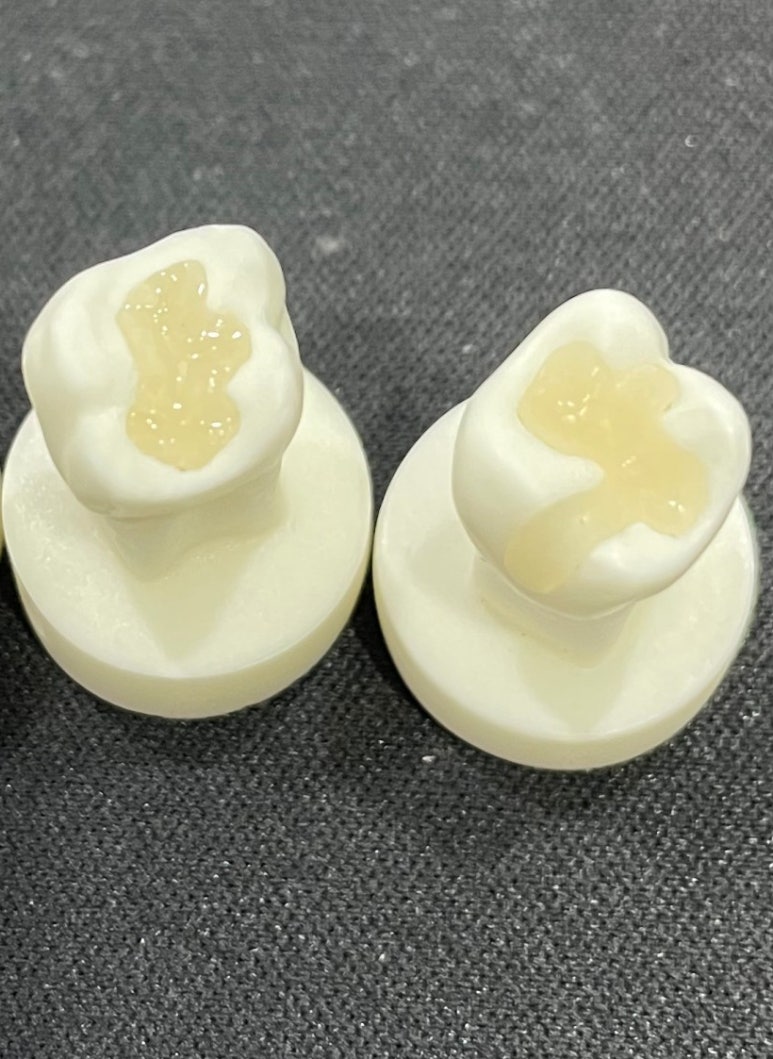 치과세라믹가격, 치과의사가 낱낱이 알려드립니다. 관련 이미지 3