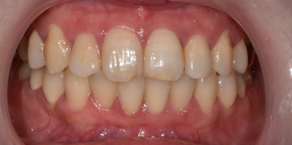 강남치과추천? 내게 꼭 맞는 치과 고르는 방법 관련 이미지 13