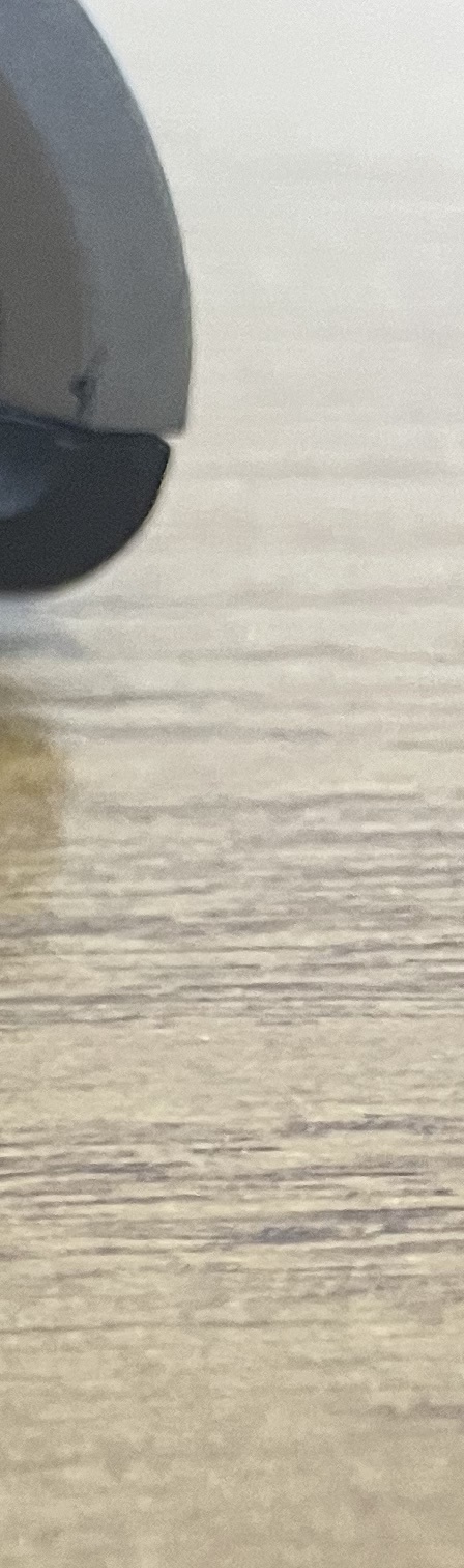 서초동 치과, 통증이 두려워 방문을 꺼리신다면? 관련 이미지 12