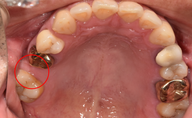 선릉역 임플란트? 관련 이미지 1