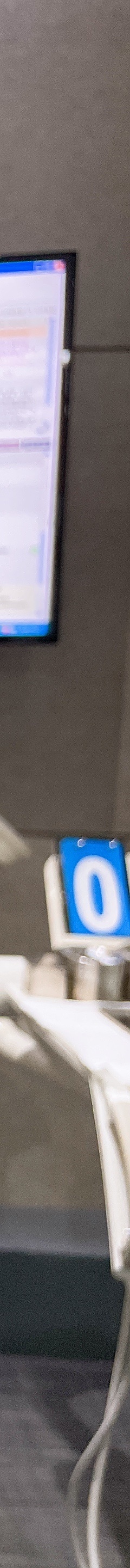 원데이 치과미백 치료? 5000건 해보고 알려드립니다. 관련 이미지 16