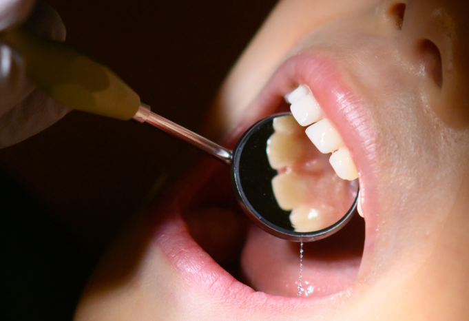 테헤란로치과 선택 전, 이 2가지는 반드시 따져보세요 관련 이미지 4