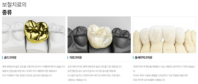 신경치료크라운 꼭 해야할까요? 관련 이미지 4