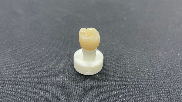 치과세라믹가격, 치과의사가 낱낱이 알려드립니다. 관련 이미지 4