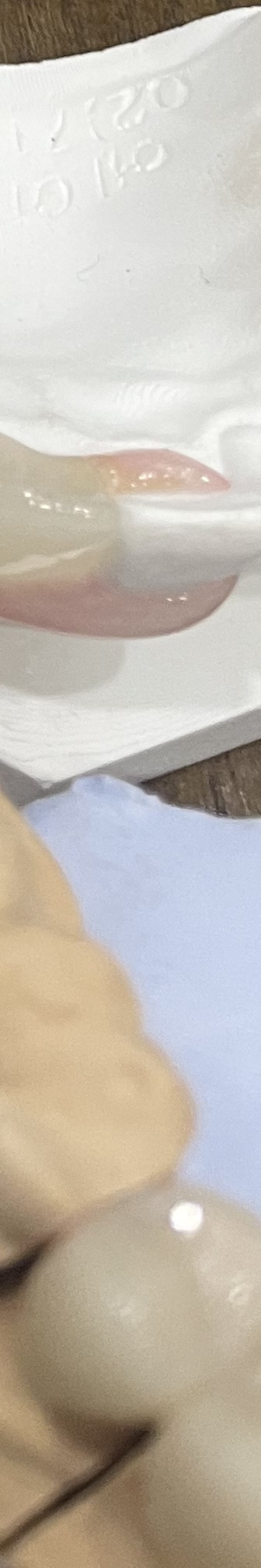 매봉역 치과, 자연치아 잃고 싶지 않다면? 관련 이미지 23