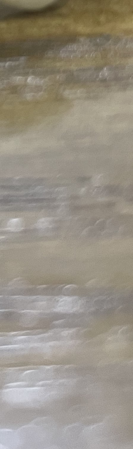 서초동 치과, 통증이 두려워 방문을 꺼리신다면? 관련 이미지 18