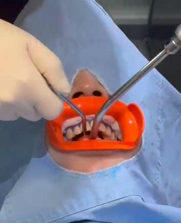 강남역치아미백, 가격보다 ‘이것’이 중요합니다 – 원장 작성 관련 이미지 6