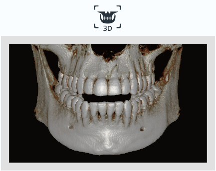 60대 이상 임플란트? 70대에도 할 수 있습니다. 관련 이미지 7