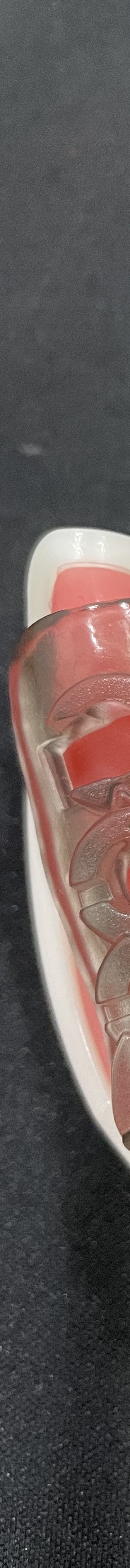 강남역 치과 임플란트 수면마취?해야만 하는 경우 관련 이미지 8