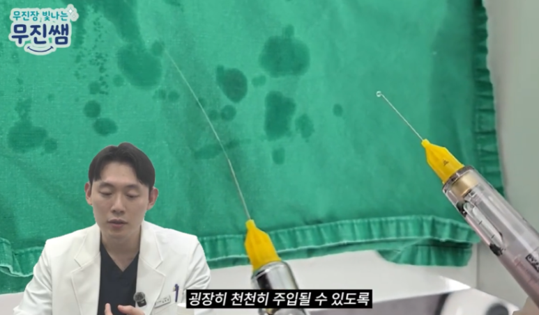 Gangnam Gum Contouring—Doesn’t It Hurt? An Honest Account of the Pain image 7