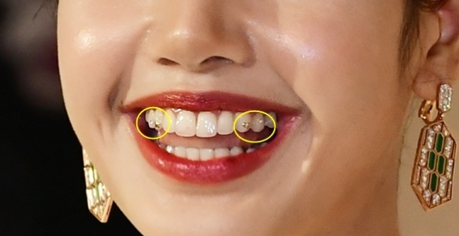 투스젬? MZ 유행이라던데 치아건강에 괜찮을까? 관련 이미지 4