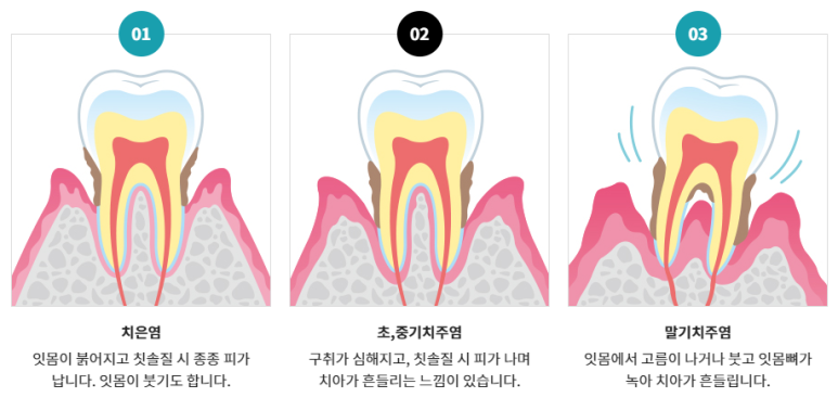 어버이날선물, 치과 검진으로 부모님 치아 건강 챙겨주세요! 관련 이미지 4