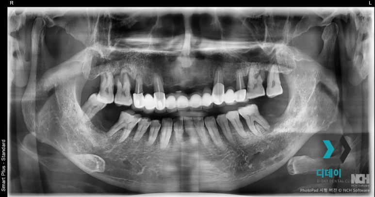 Looking for a recommended dental clinic near Seolleung Station? You only need to know 2 things image 3