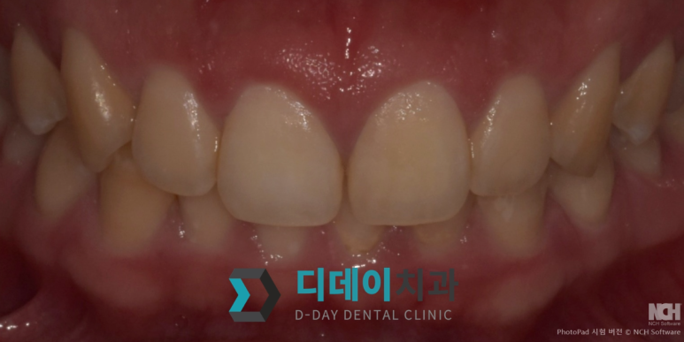 구강전정술 잘하는곳? 이 2가지 모르면 못찾습니다 관련 이미지 7