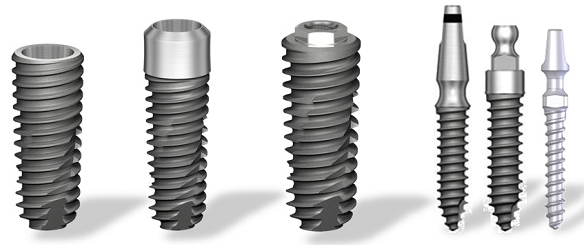 임플란트구조, 의사가 알려주는 2가지 핵심 구성요소 관련 이미지 3