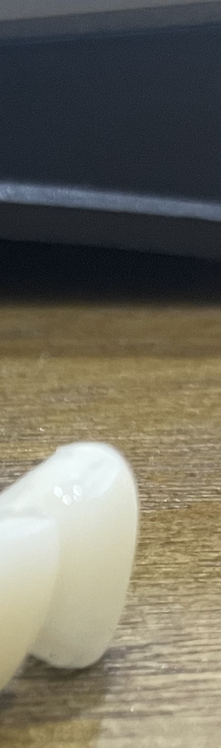 서초동 치과, 통증이 두려워 방문을 꺼리신다면? 관련 이미지 10