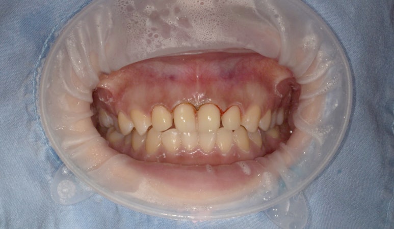 라미네이트 #내돈내산 찐후기 (feat. 직원이 받은 솔직후기2) 관련 이미지 3