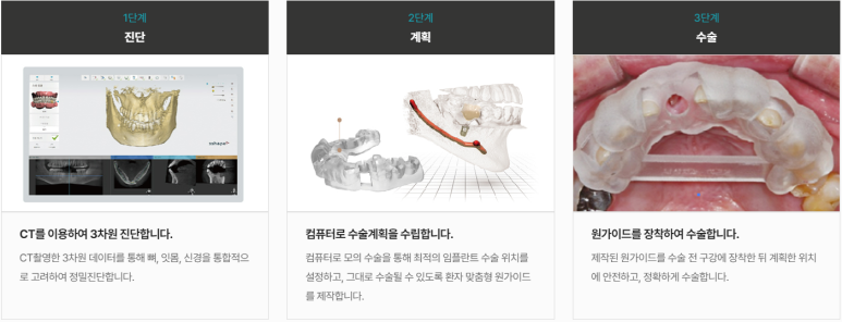 네비게이션임플란트가격, 일반 임플란트보다 비싼 이유? 관련 이미지 2