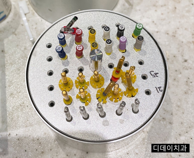 치아착색? 치아변색? 하얀 치아로 만드는 방법 공개 관련 이미지 6