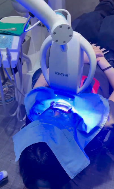 레진인레이차이, 실패하지 않으려면 이 2가지만 확인하세요 관련 이미지 8