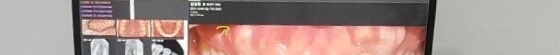 구강전정술 잘하는곳? 이 2가지 모르면 못찾습니다 관련 이미지 13