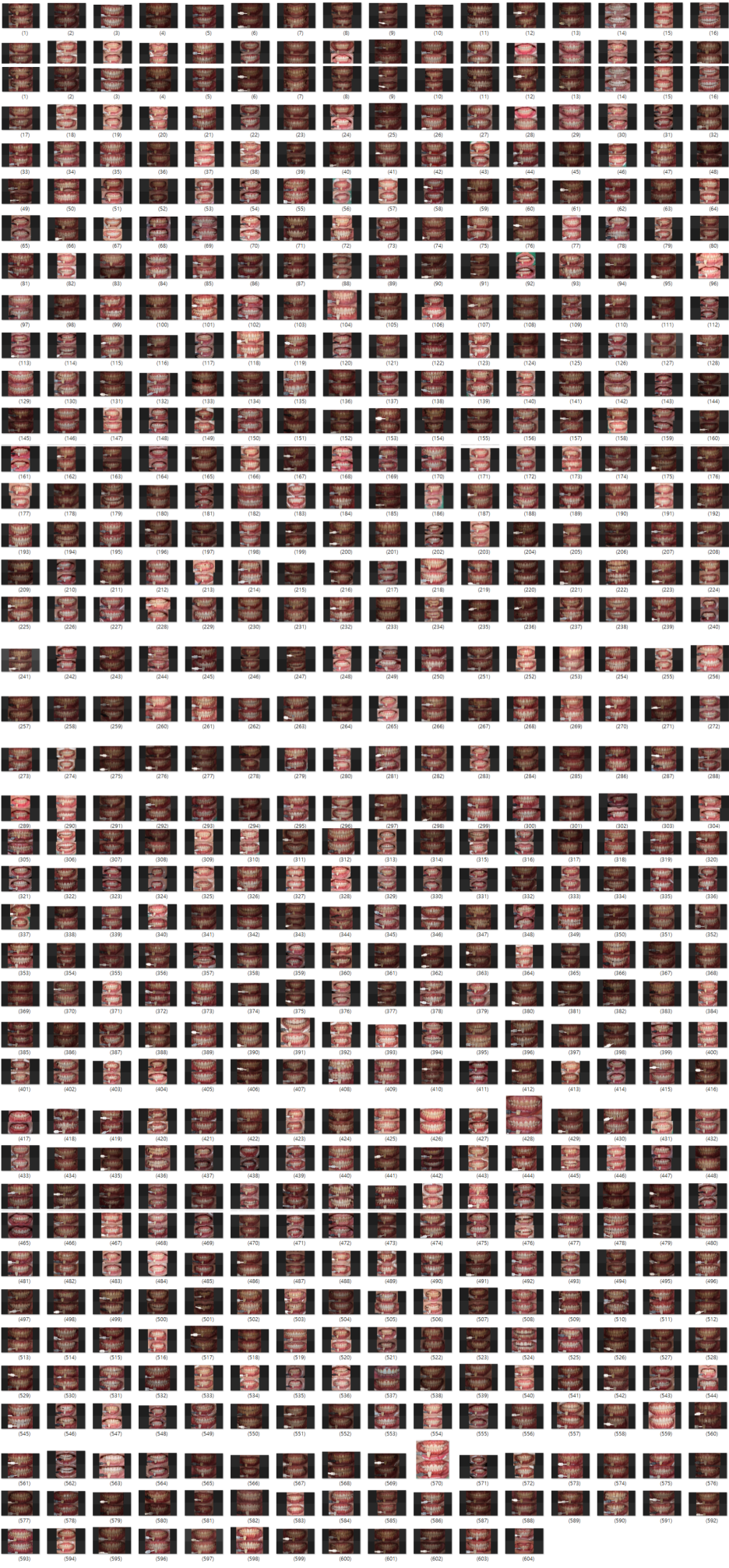 프로필 촬영 전 치아미백 꼭 필요할까요? 관련 이미지 2