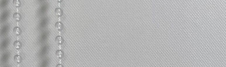 치아미백 vs 라미네이트, 누렁니 탈출하고 싶으신 분들만 관련 이미지 10