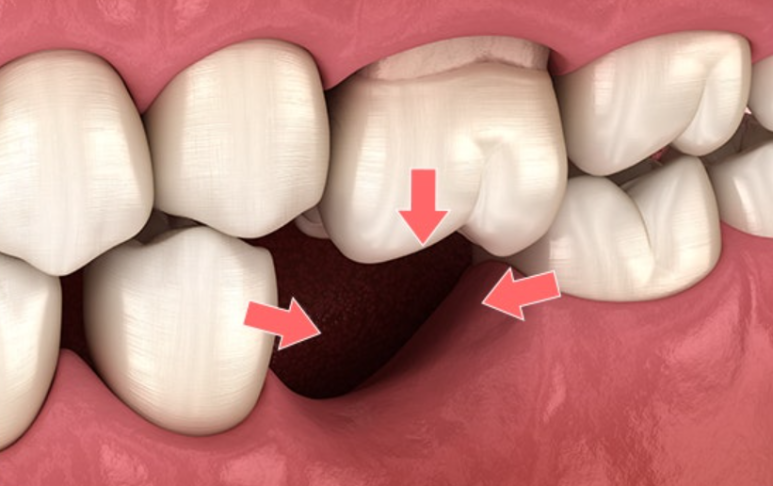 역삼동치과, 후기만 믿고 갔다가 후회하는 이유 관련 이미지 5