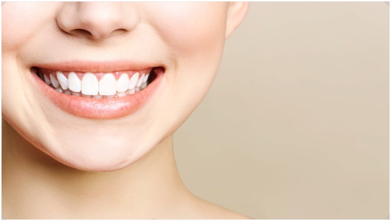 연예인잇몸성형? 시술 전 확인하세요. 관련 이미지 2