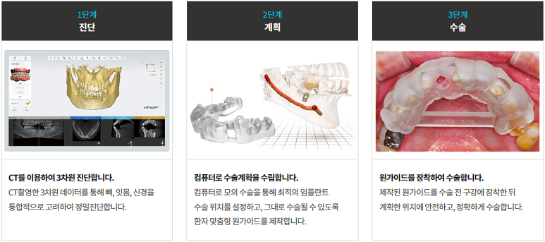 국산임플란트재료? 가격 걱정이 있으시다면 확인하세요. 관련 이미지 1