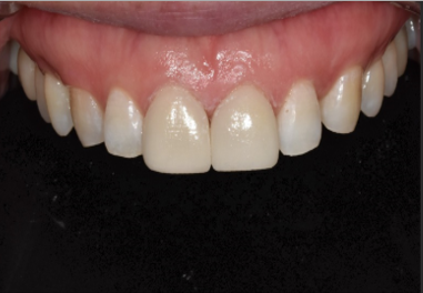 삼성중앙역치과? 전문의 밝히는 진실 관련 이미지 2