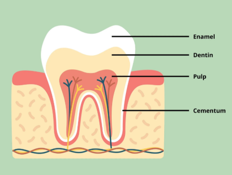 Why Does Acute Pulpitis Occur? The Answer Is Obvious. image 3
