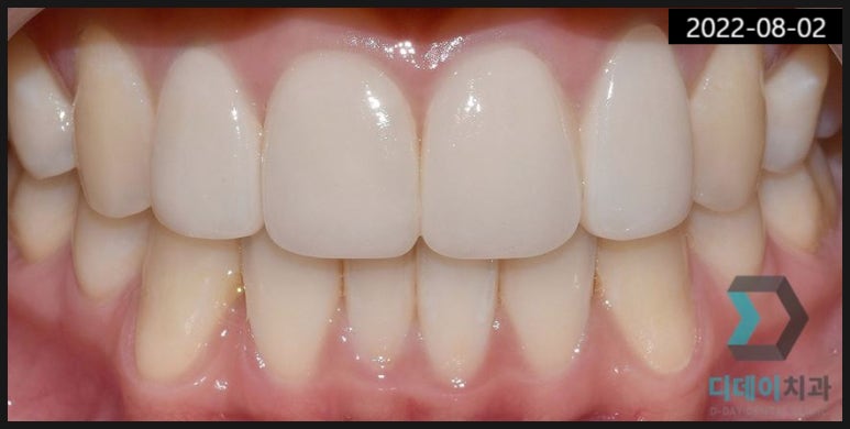 학동역 치과? 치료받고 후회하지 않으려면... 관련 이미지 3