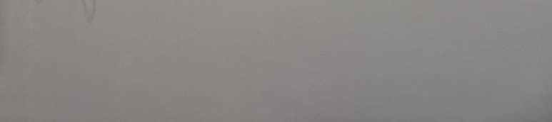 역삼역 치과 가격, 비싸다고 무조건 잘하는 건 아닙니다 관련 이미지 19