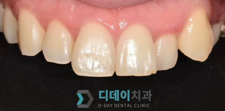 강남구청역/압구정로데오역 치과? 00부터 확인하세요 관련 이미지 1