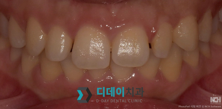 라미네이트종류, 이것만 확인하면 됩니다 관련 이미지 11