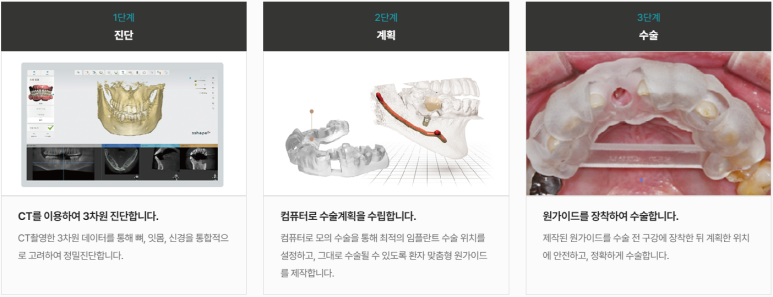 임플란트부작용 걱정? 이 글 보시면 걱정 안하셔도 됩니다. 관련 이미지 5