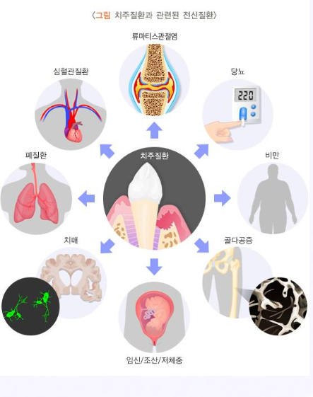 삼성역치과 임플란트 고민만 6개월째라면, 이 글이 마지막이 됐으면 합니다 관련 이미지 3