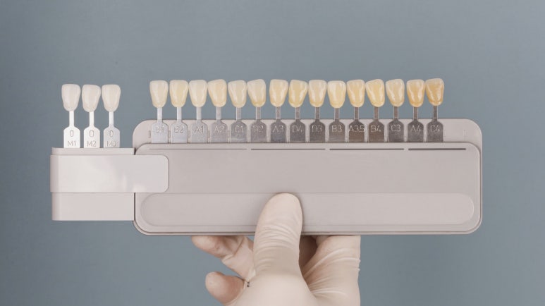 치아미백유지기간부터 종류, 주의사항까지 알려드립니다 관련 이미지 15