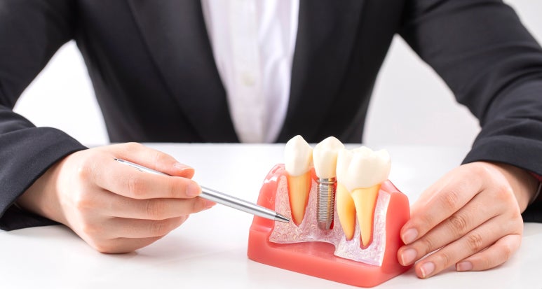 삼성중앙역치과, 과잉진료 피하려면? 이런 치과는 주의하세요. 관련 이미지 3