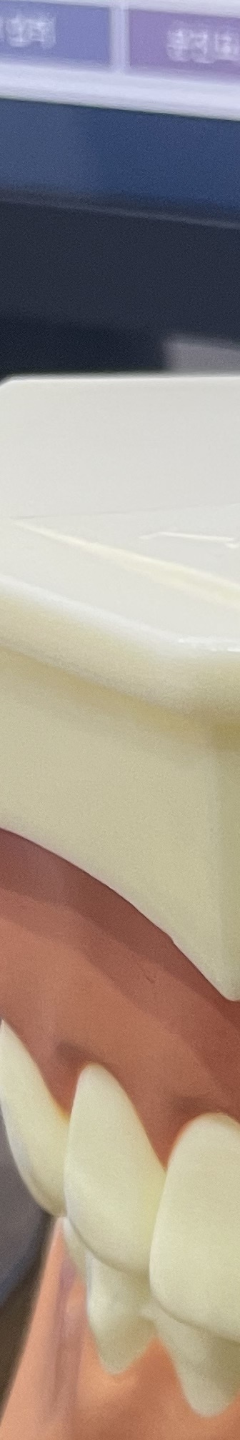 양재역 치과, 실력과 양심 두마리 토끼를 놓치지 않는 방법 관련 이미지 12