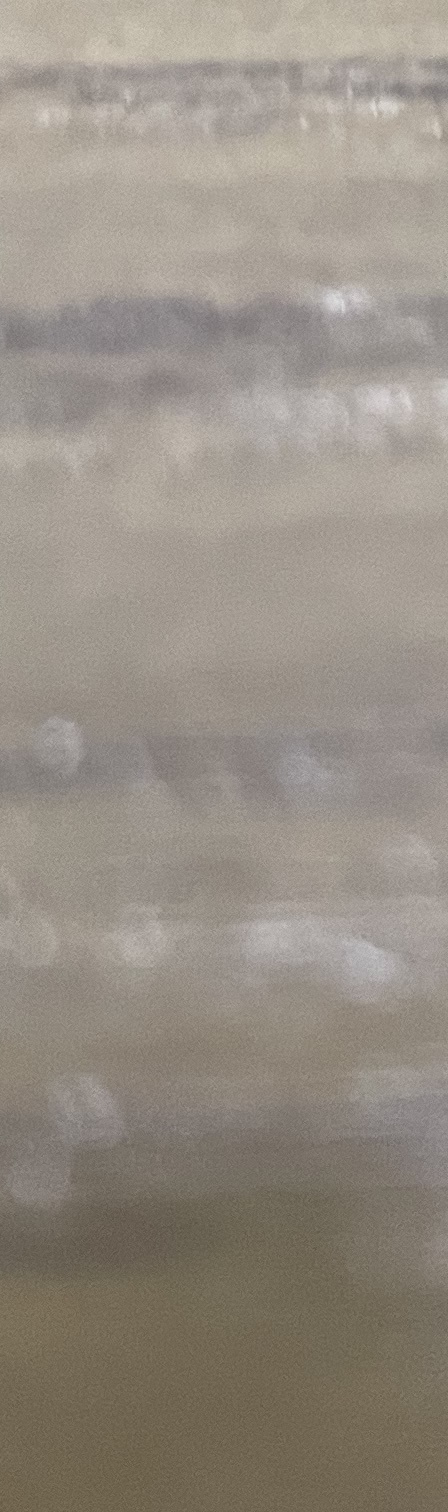 서초동 치과, 통증이 두려워 방문을 꺼리신다면? 관련 이미지 13